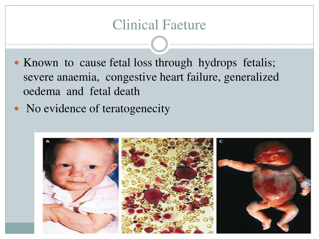 clinical faeture