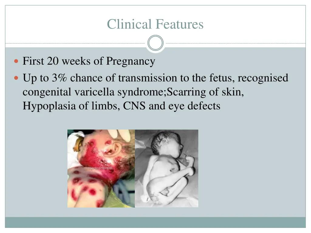 clinical features 1