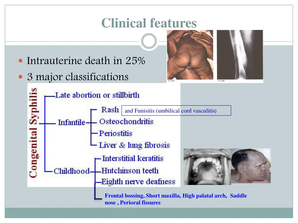 clinical features