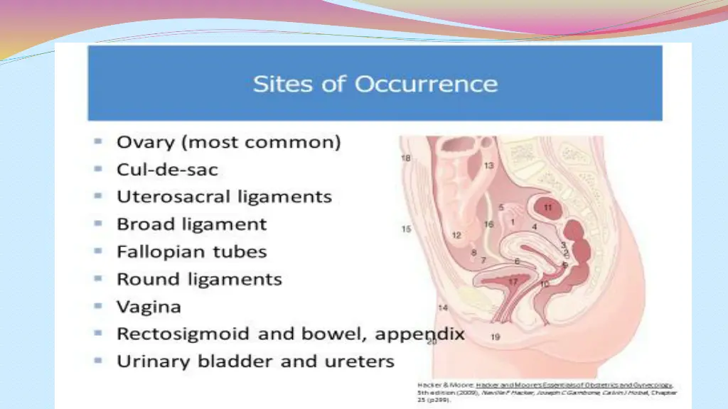slide3