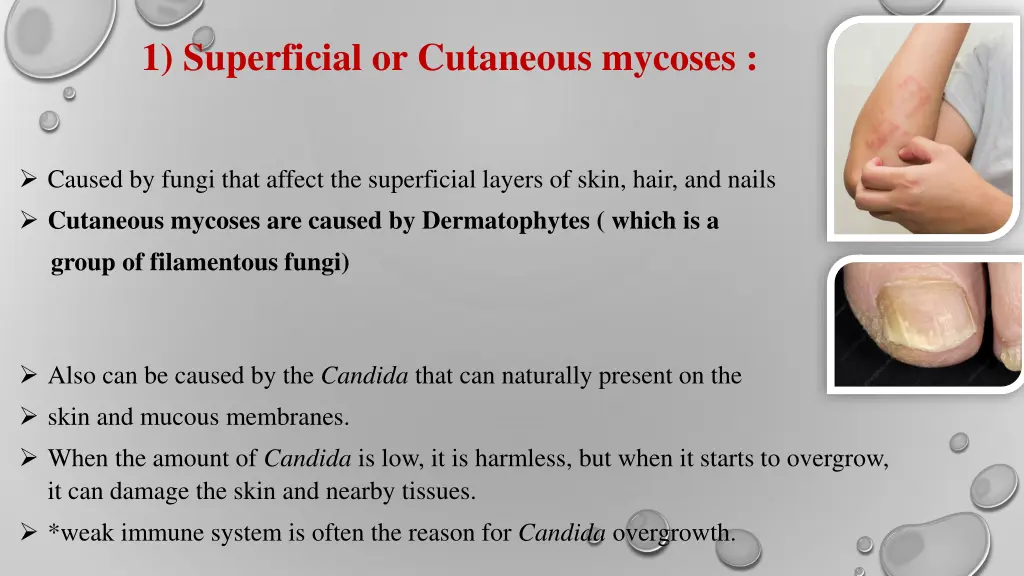1 superficial or cutaneous mycoses