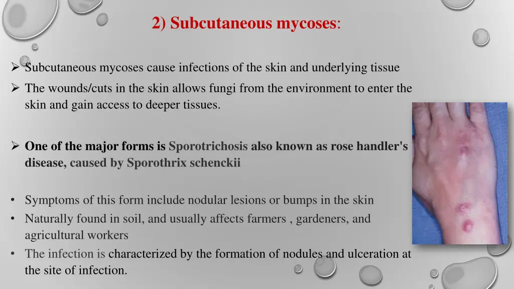 2 subcutaneous mycoses