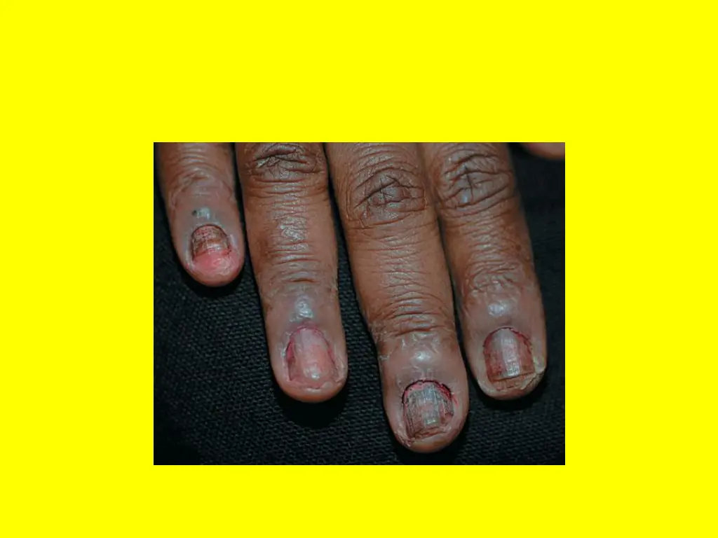 slide11