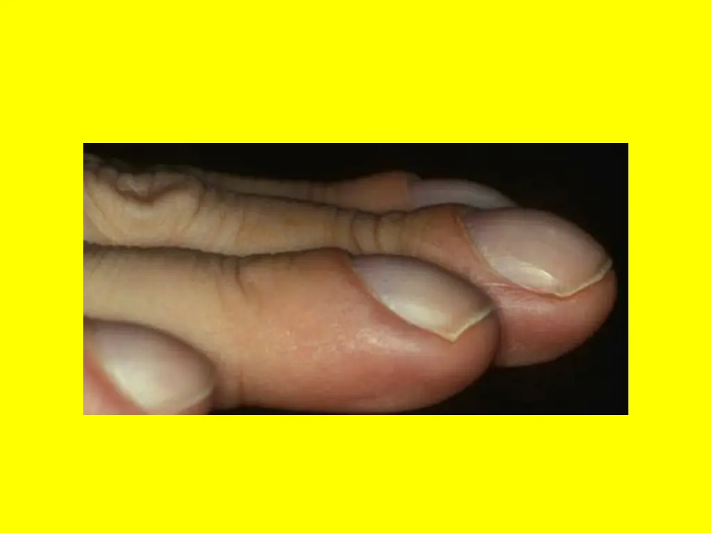 slide16