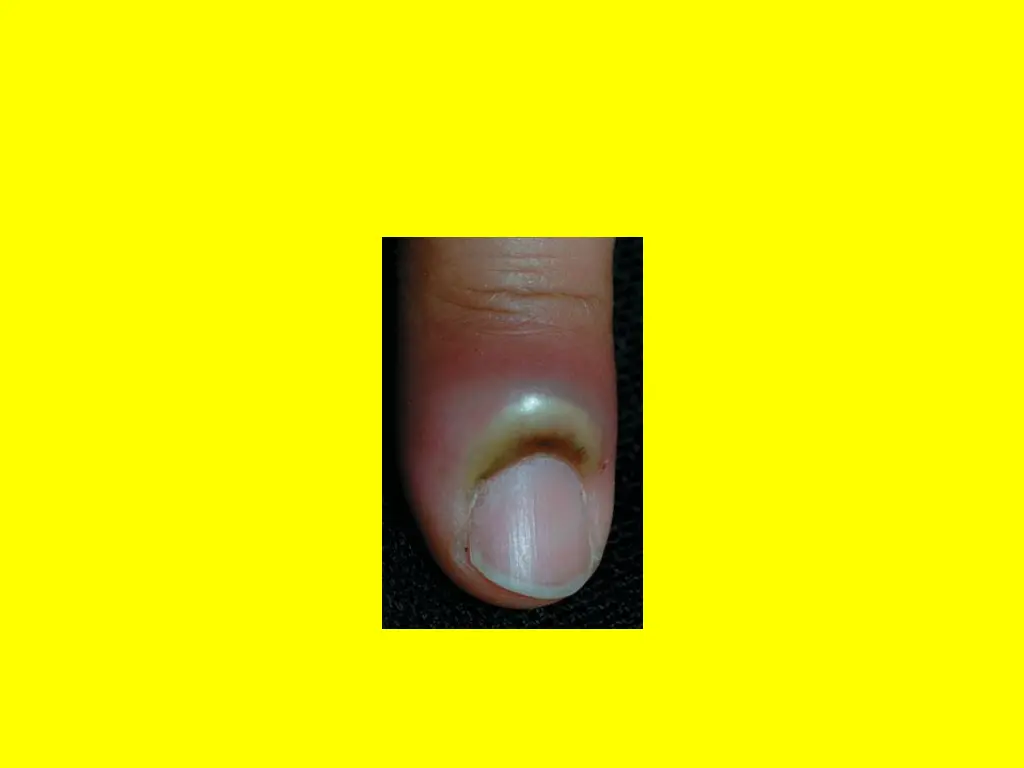 slide8