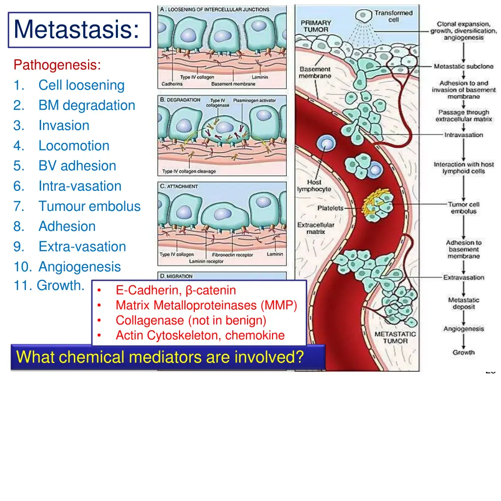 metastasis
