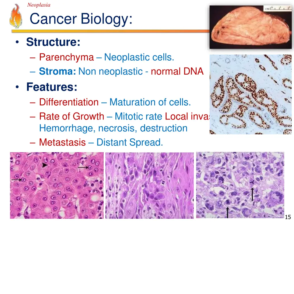 neoplasia cancer biology