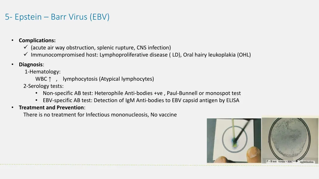 5 epstein barr virus ebv 1