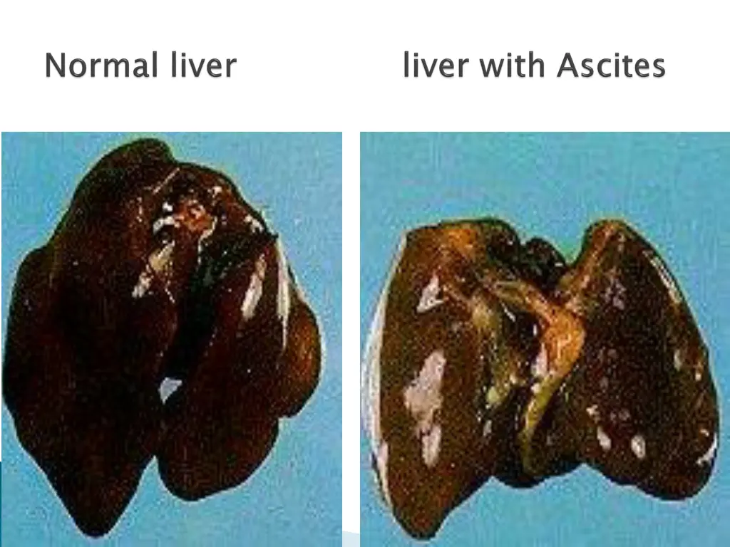 slide13