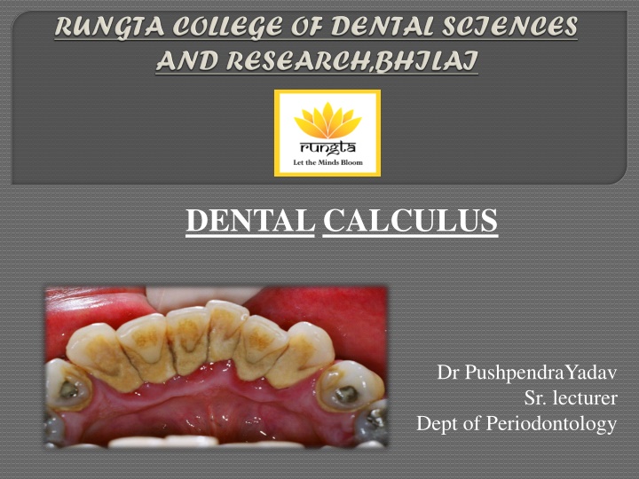 dentalcalculus