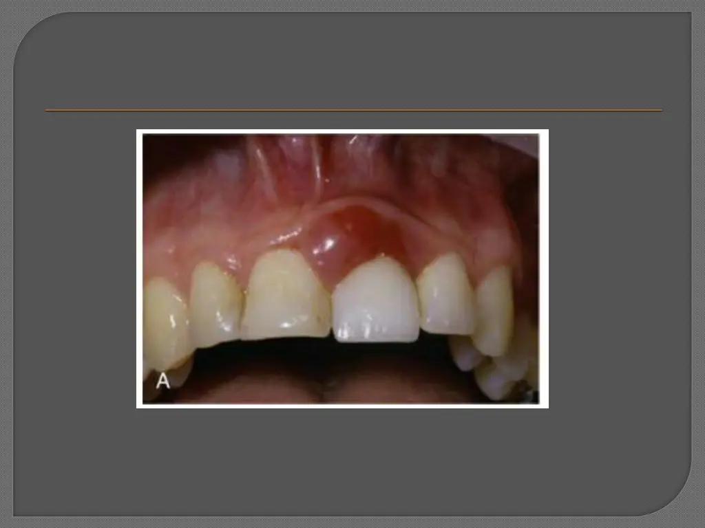 slide27