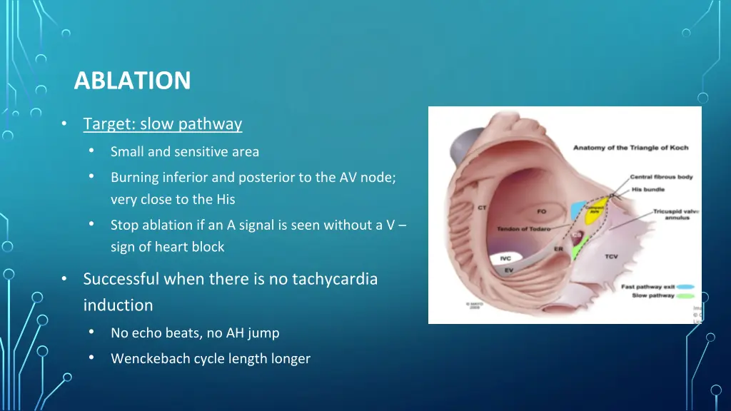 ablation