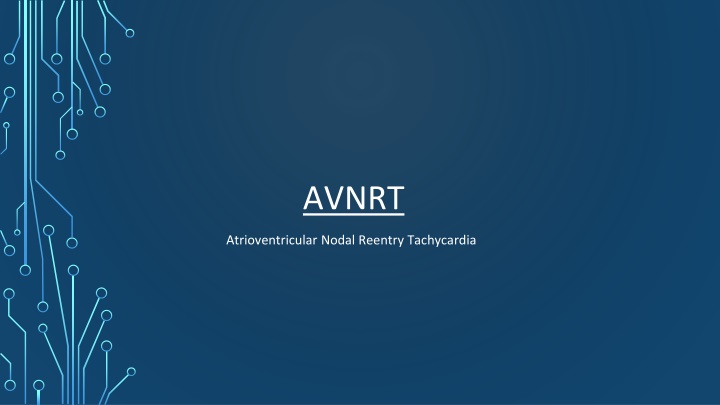 avnrt