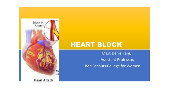 heart block