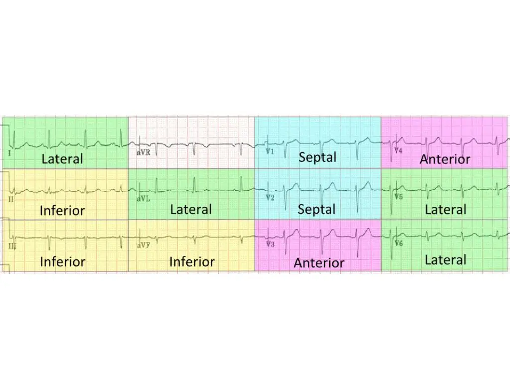 slide9
