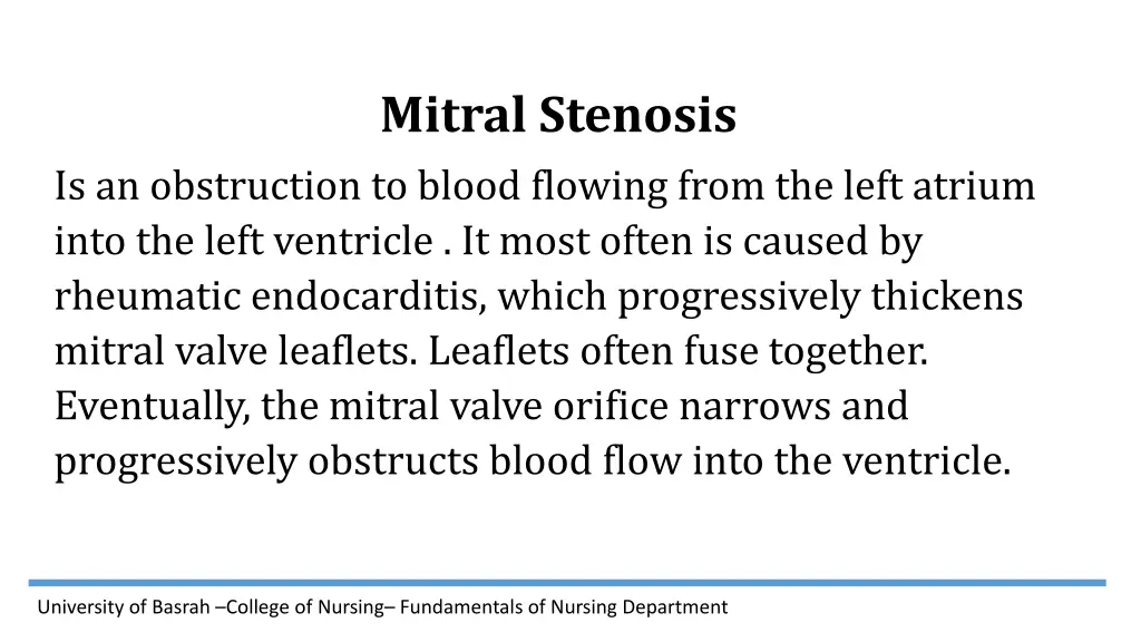 mitral stenosis