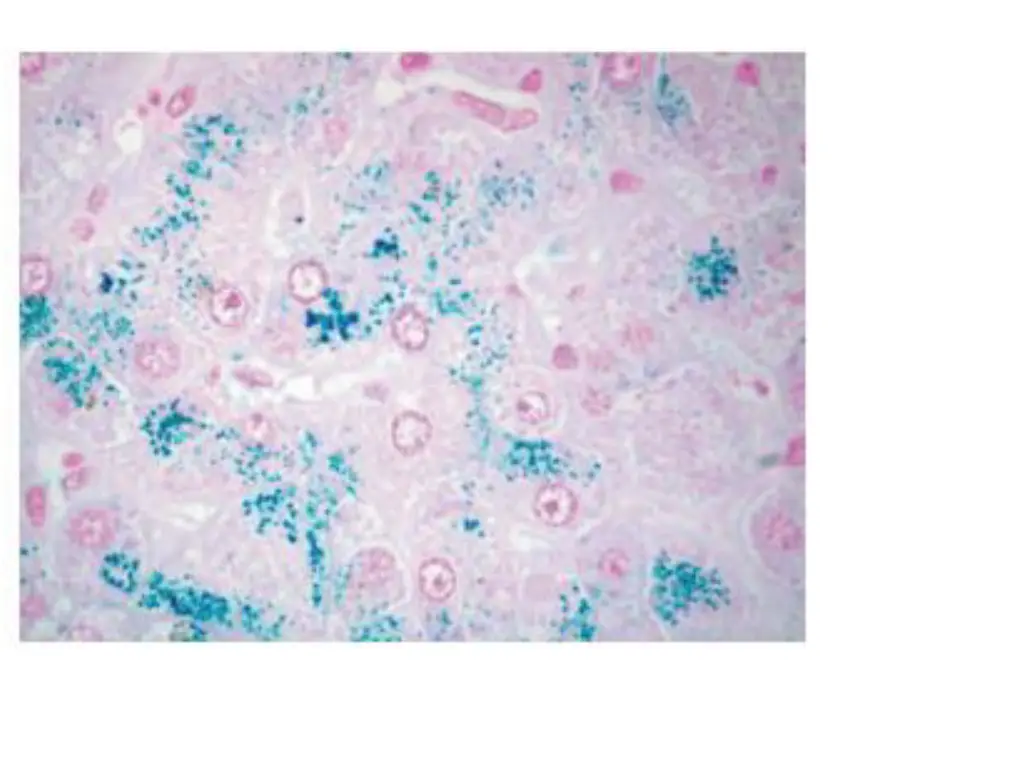 slide28