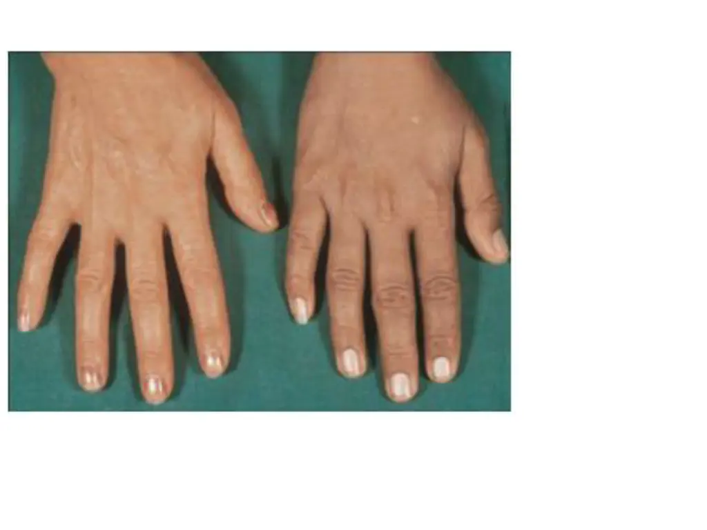 slide29