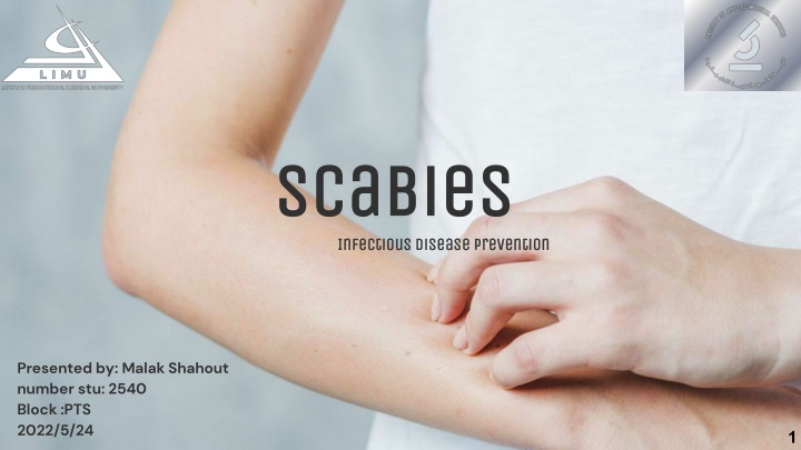 scabies scabies infectious disease prevention