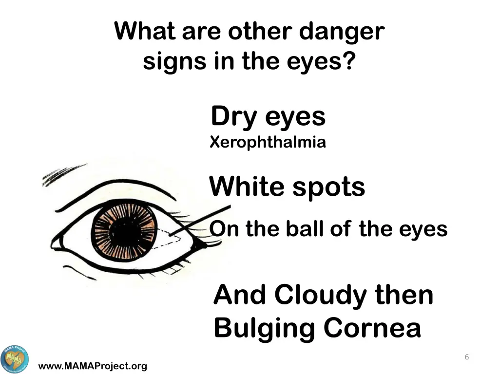 what are other danger signs in the eyes
