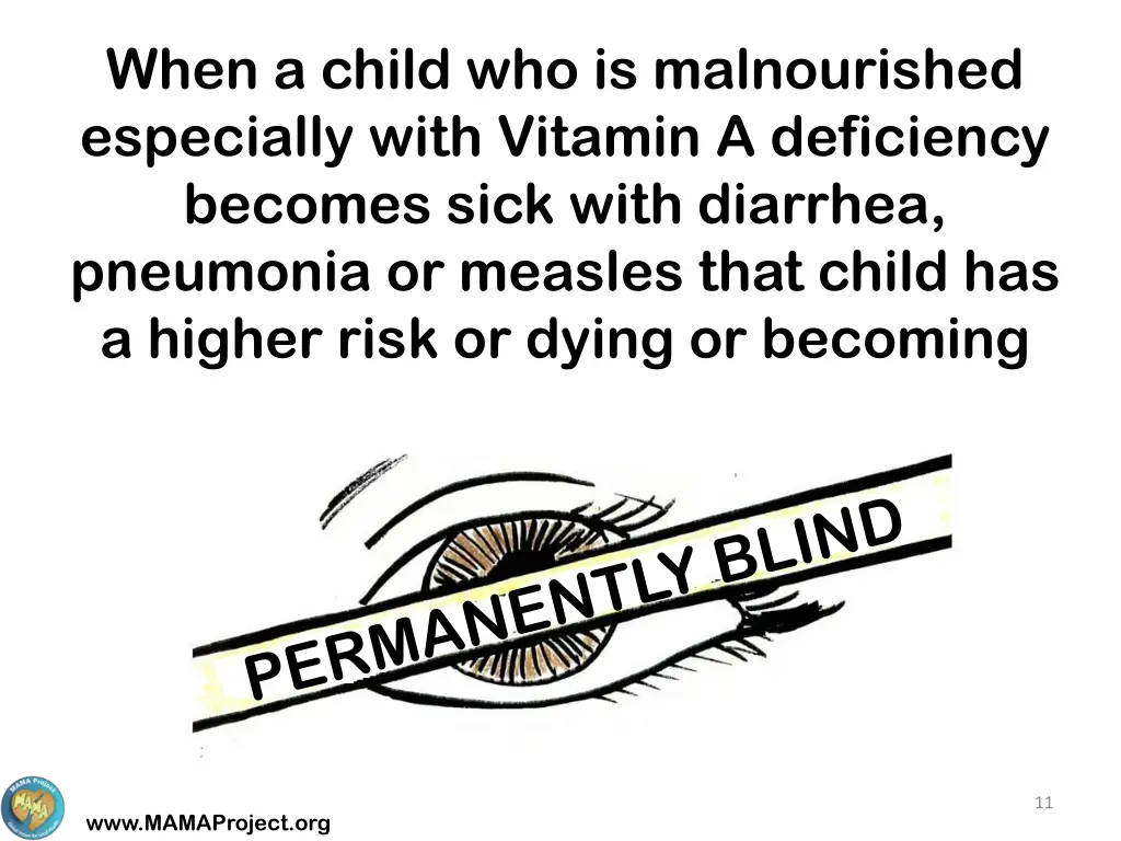 when a child who is malnourished especially with