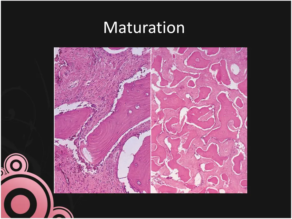 maturation