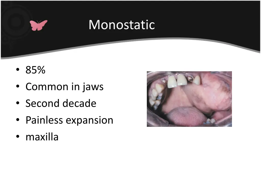 monostatic