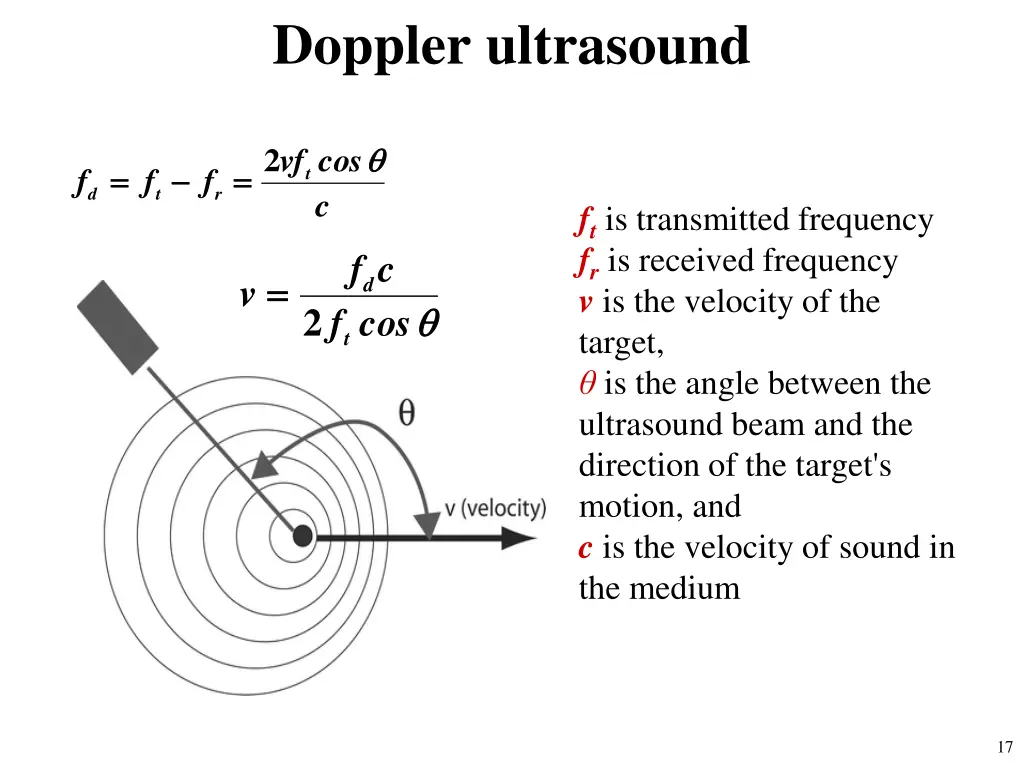 doppler ultrasound 1