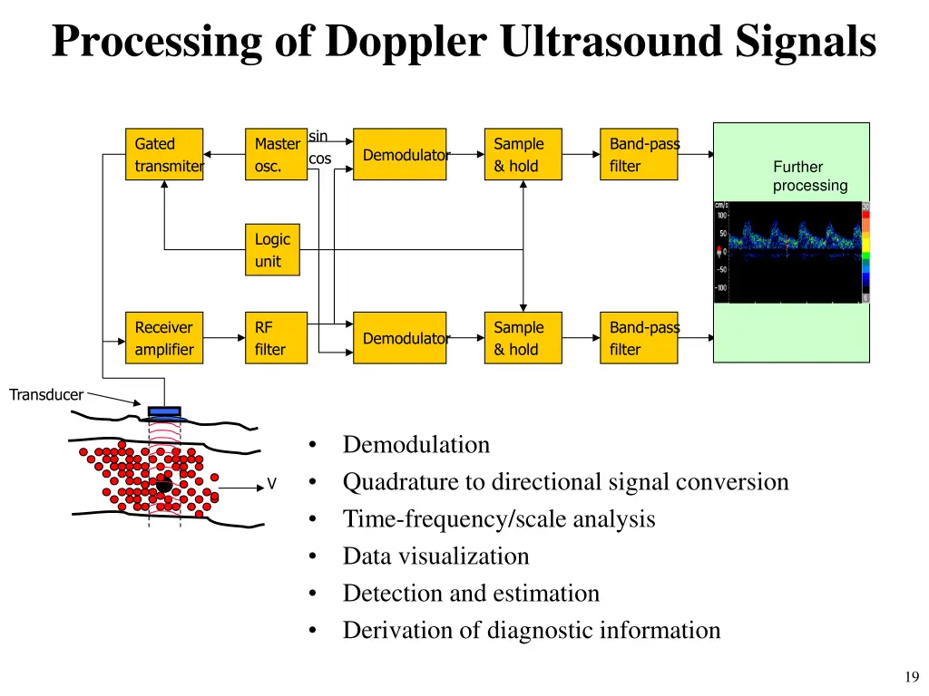 processing of doppler ultrasound signals