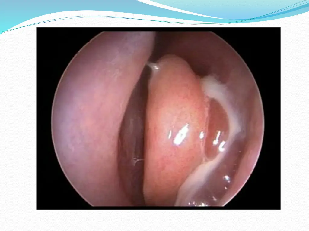 slide7