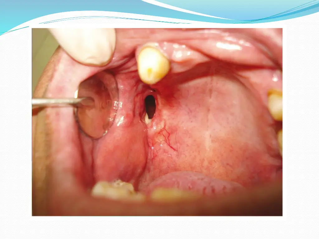 slide9