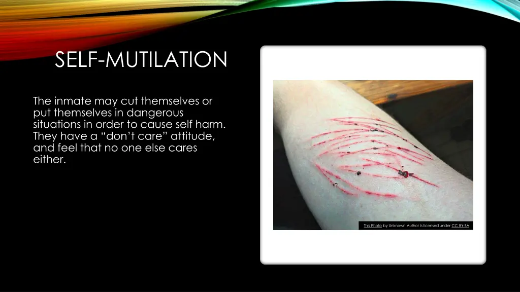 self mutilation