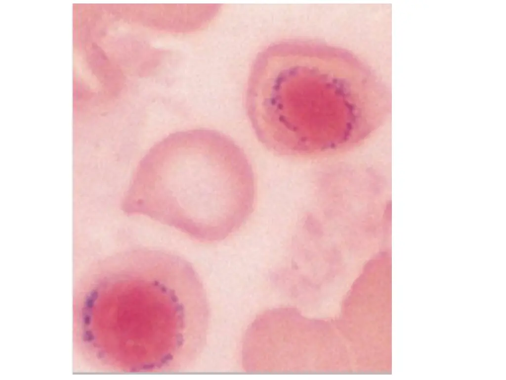 slide7
