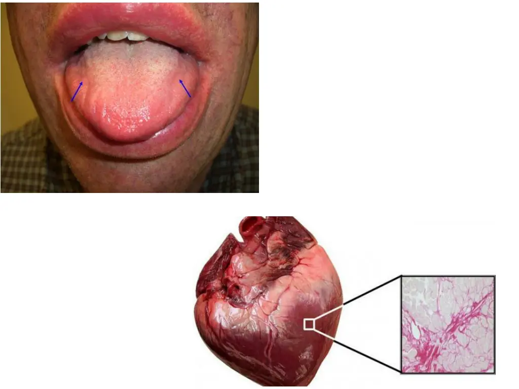 slide10