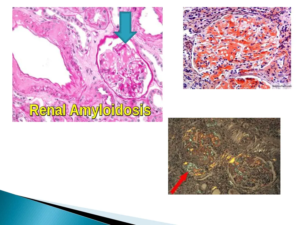 slide3