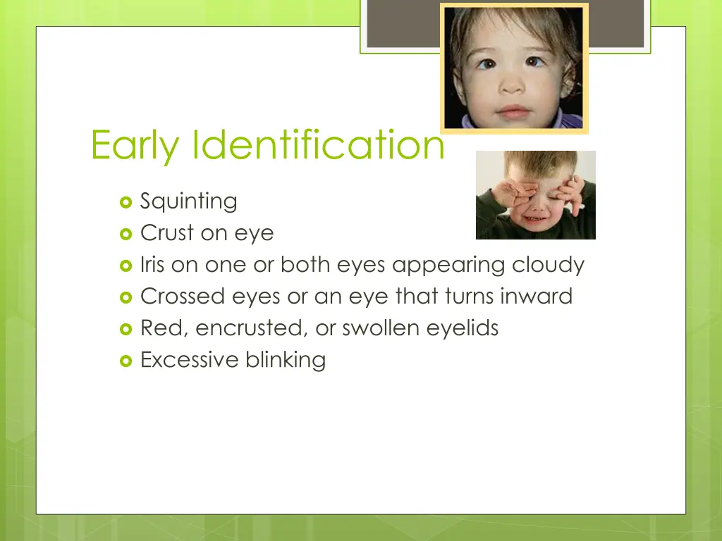 http www pedseye com img eso ex 03 jpg