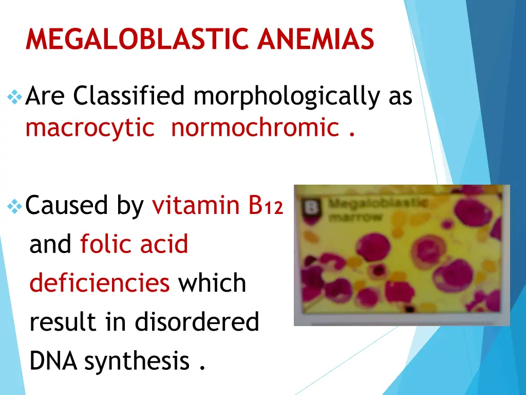 megaloblastic anemias