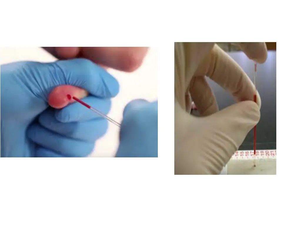 slide7
