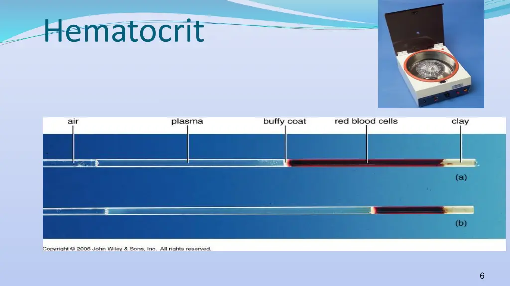 hematocrit