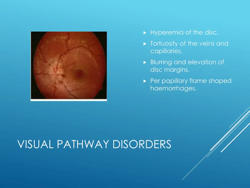 hyperemia of the disc