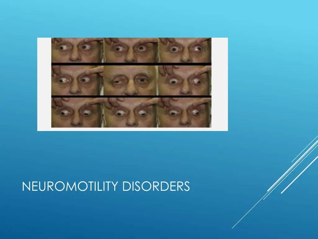 neuromotility disorders 1