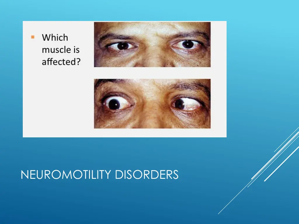 neuromotility disorders 2