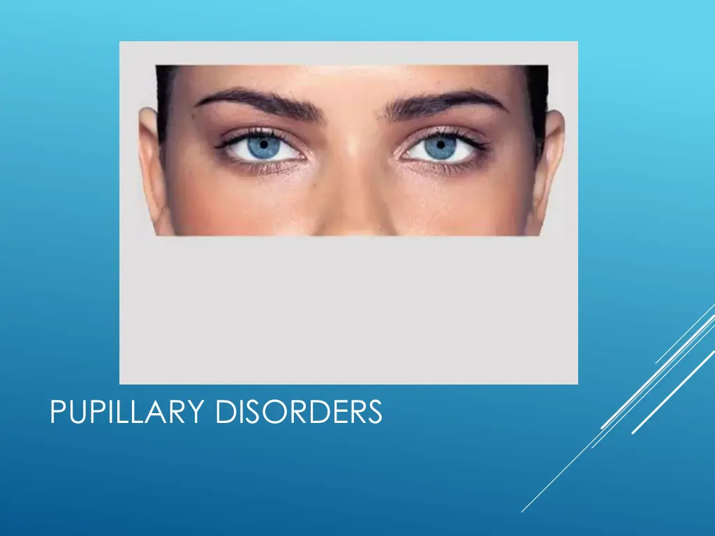 pupillary disorders 1