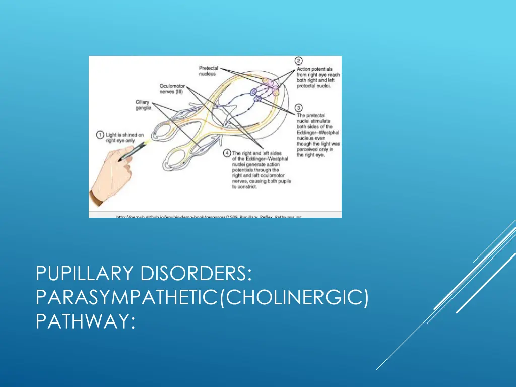 pupillary disorders parasympathetic cholinergic