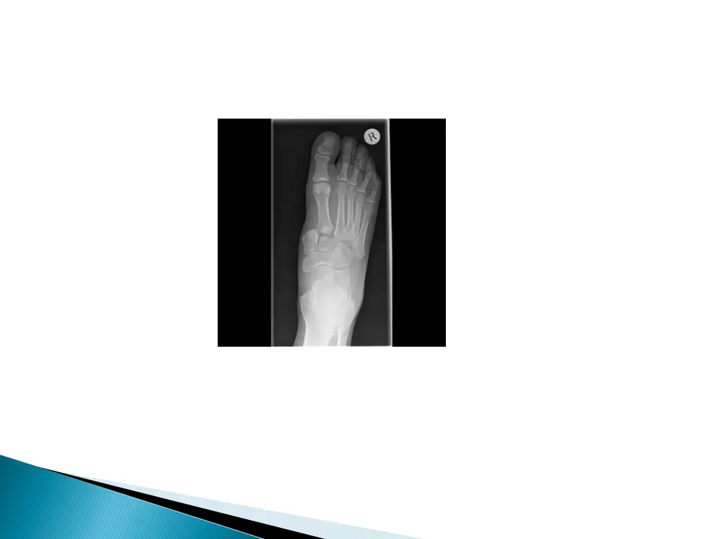 http images radiopaedia org images 550767