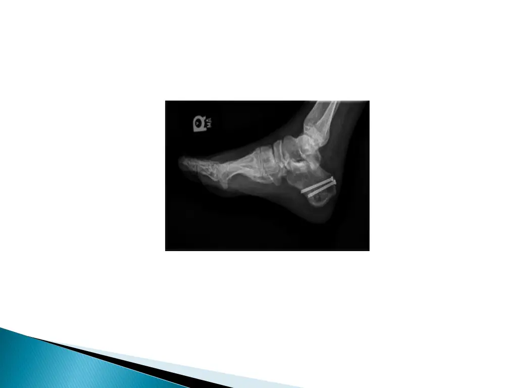 slide12