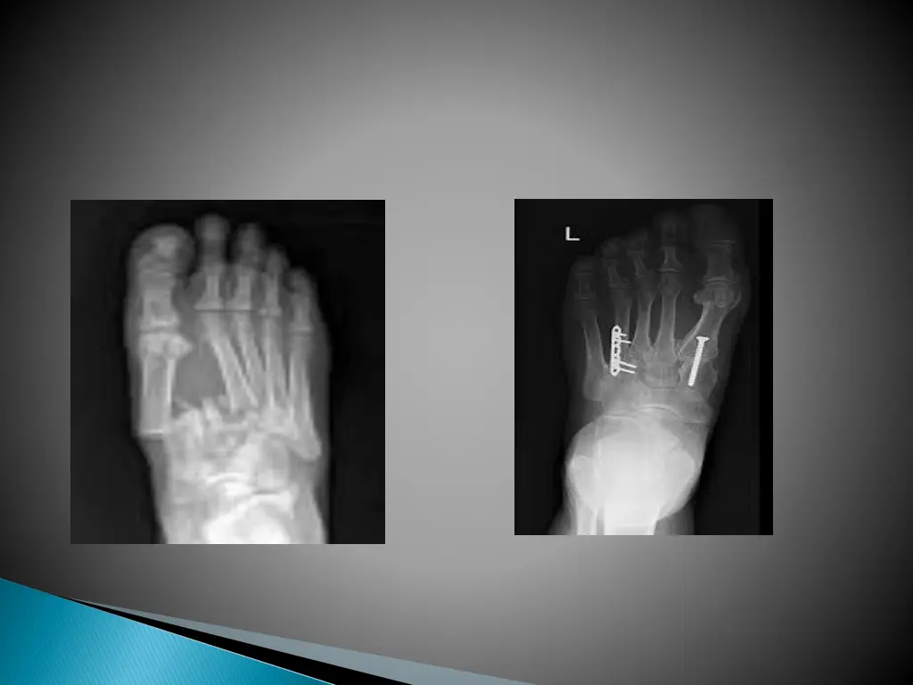 slide17