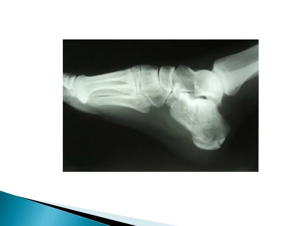 slide7
