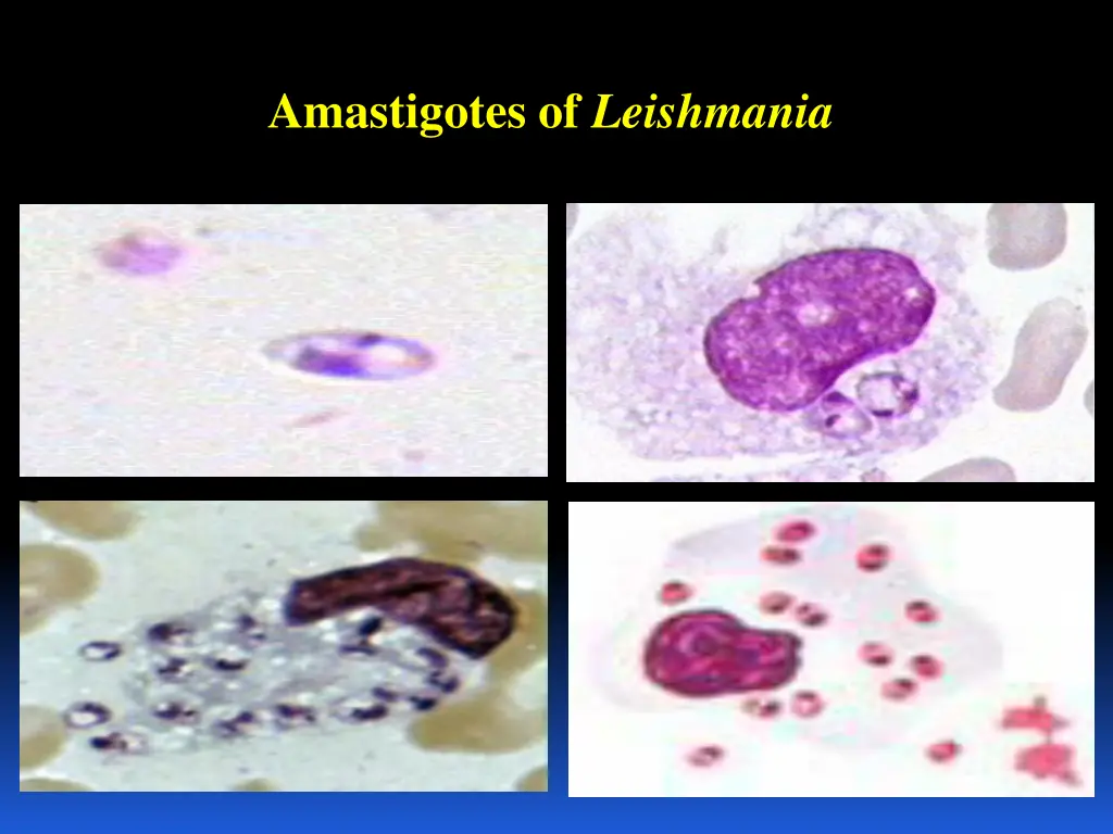 amastigotes of leishmania