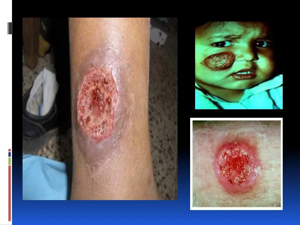 slide14